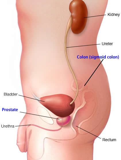 colon_and_prostate